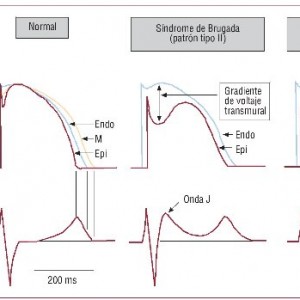 25v62n11-13142828fig4